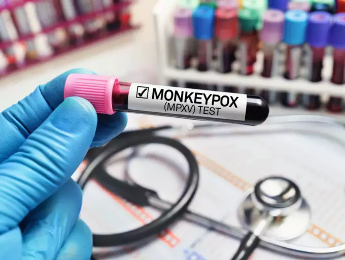 Well, It Seems Monkeypox Could Spread Asymptomatically, So What Now?